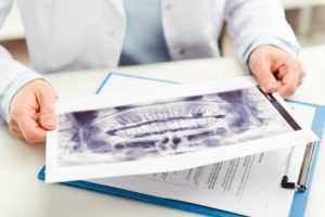 Dental assistant looking at a set of panoramic x-rays. 